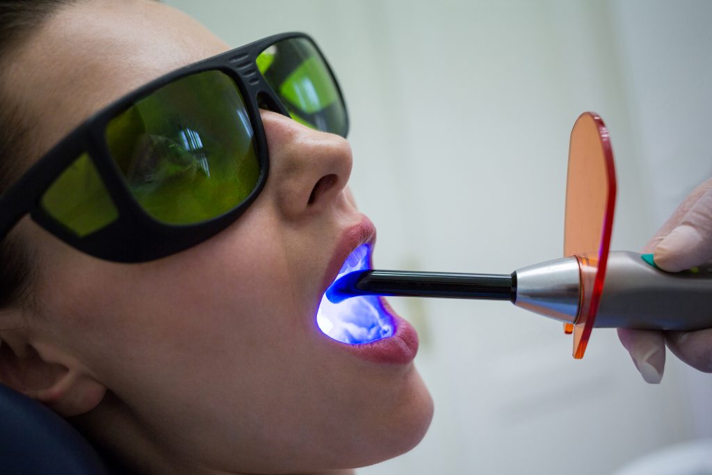 dental laser treatment in chennai